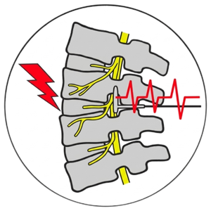 Schmerzchirurgie und Neuromodulation